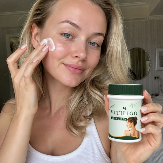 Vitiligo Vårdkräm – Närande Hudvårdsformula För Ojämnt Hudutseende