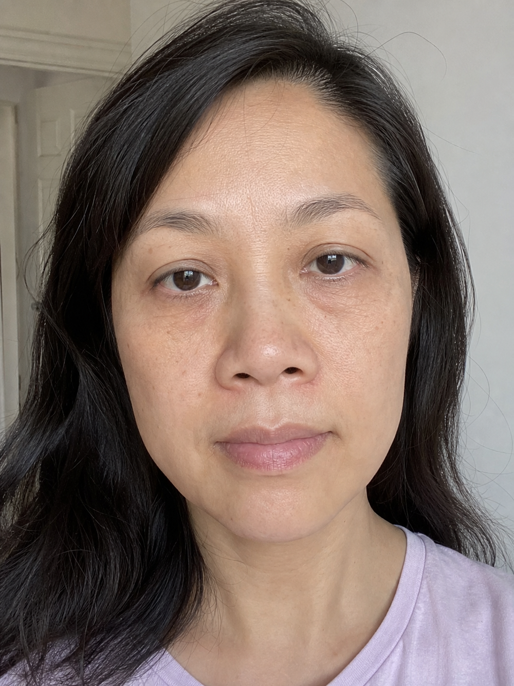 Före rutinen – Svenska Beauty kundbild