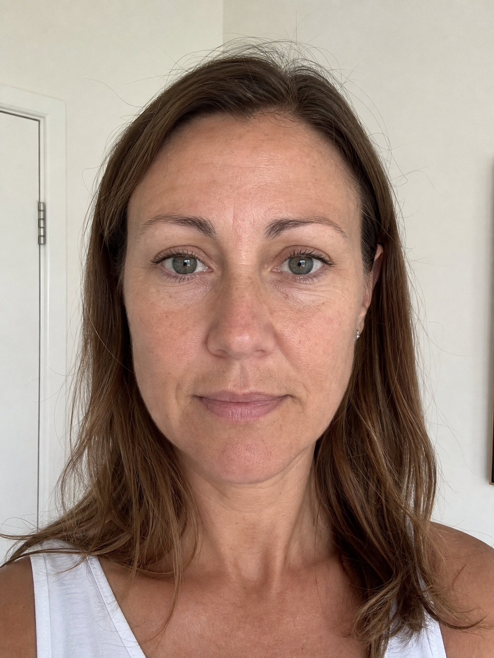 Före rutinen – Svenska Beauty kundbild