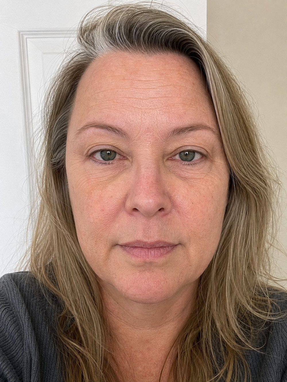 Före rutinen – Svenska Beauty kundbild